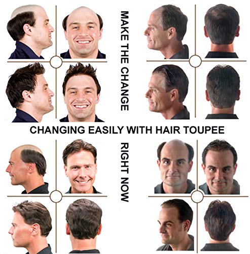NLW Men's Toupee Hair Replacement System - 8x10