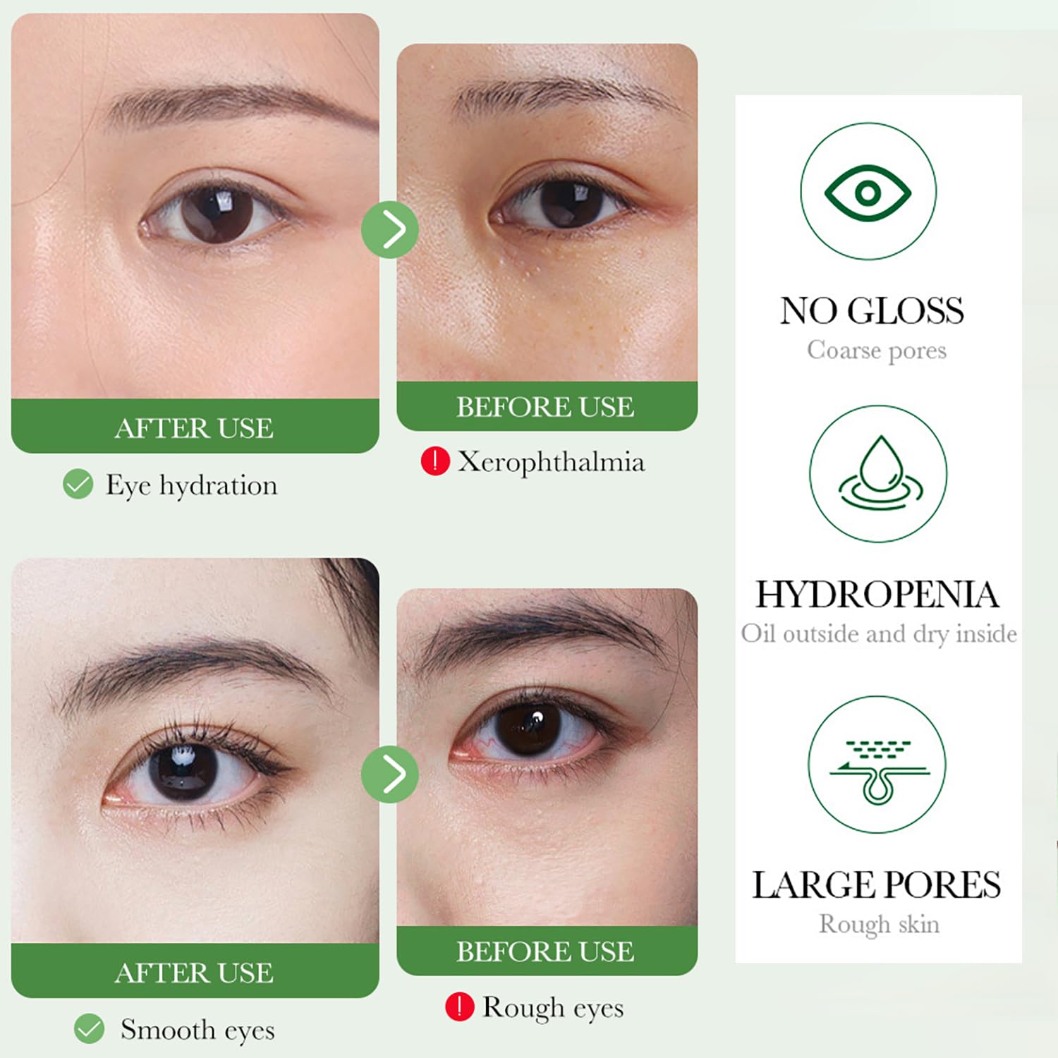 BIOAQUA Centella Asiatica Eye Cream - Soothing & Repairing Anti-Acne Treatment, Oil Control & Nourishing Formula (20g/0.7oz) - Perfect for Sensitive Skin & Nighttime Skincare Routine