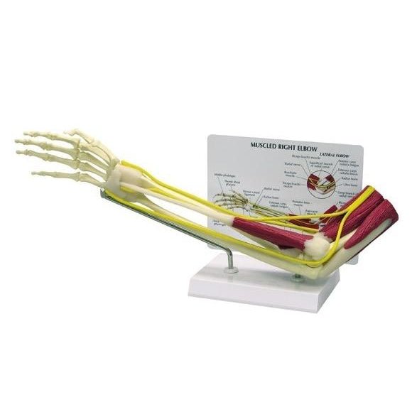 Elbow Joint Model with Muscles - Anatomical Human Arm Model for Medical Education & Physical Therapy - Perfect for Classroom, Clinic & Home Study