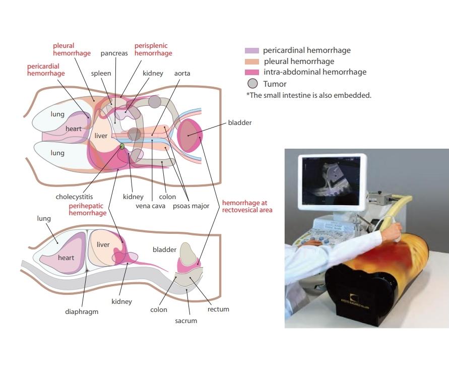 Fast Acute Abdomen Phantom - High-Quality FAST ER FAN Ultrasound Training Model for Trauma Sonography | Ideal for Medical Simulation, Emergency Room Training & Diagnostic Practice