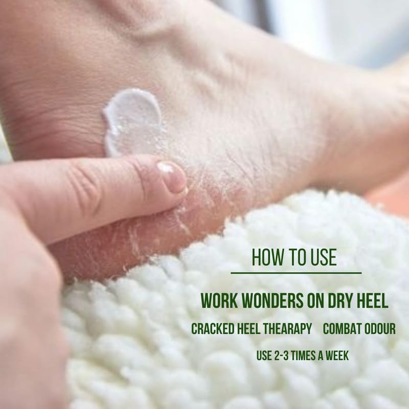 BodyHerbals Natural Foot Cream for Dry, Cracked Heels - Moisturizing Treatment with Shea Butter, Beeswax & Lemon | Callus & Cracked Skin Repair | Paraben & Sulfate Free | Men & Women | All Skin Types | Perfect for Nightly Foot Care & Pedicure Prep