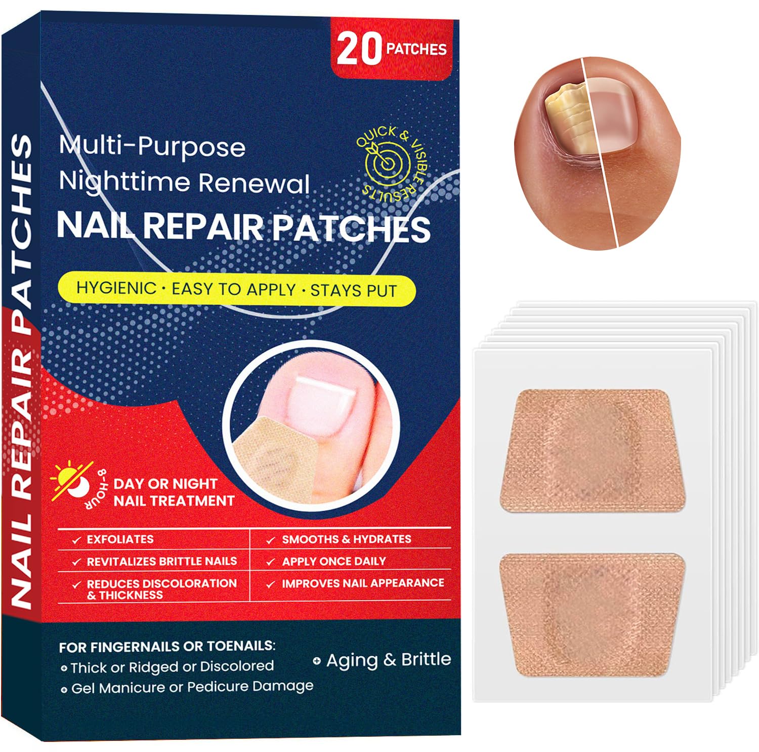 Extra Strength Toenail & Fingernail Fungus Treatment - Fast-Acting Nail Repair Solution with Nighttime Renewal Patches | Effective for Athlete's Foot, Discolored Nails & Fungal Infections at Home