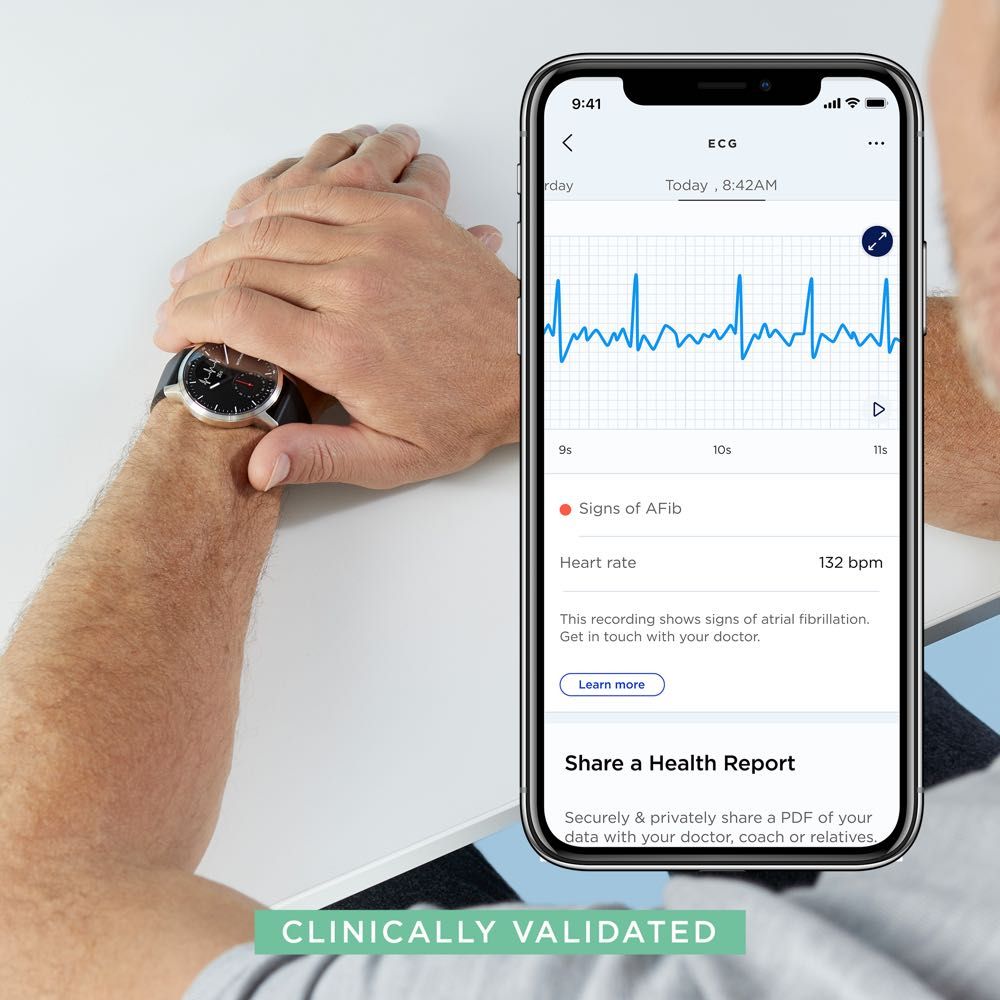 Withings ScanWatch 38mm Hybrid Smartwatch with ECG, Heart Rate & SpO2 Monitor - Track Sleep, Fitness & Heart Health for Active Lifestyles