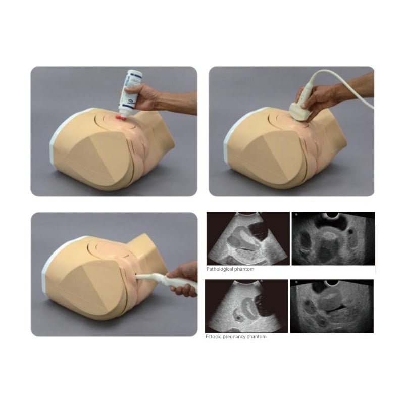 Female Pelvic Ultrasound Phantom for Transvaginal & Transabdominal Training - Obstetrics & Gynecology Practice Model for Medical Simulation & Education
