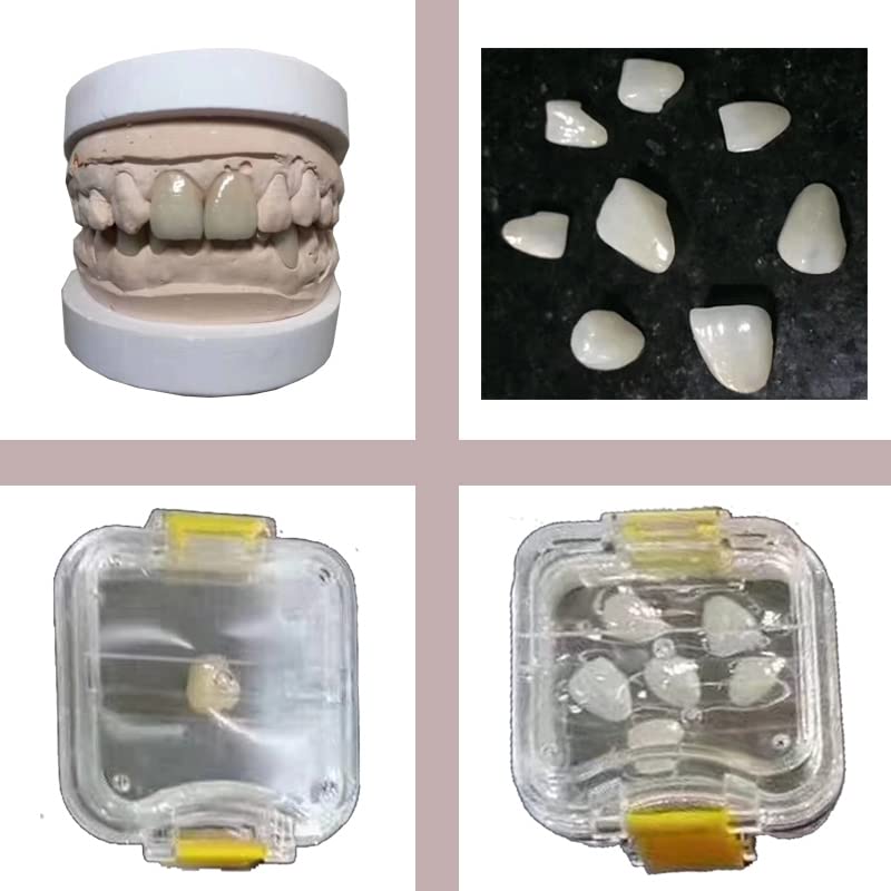 100 Pcs Dental Crown Storage Box with Membrane - Small Yellow Denture Veneer Containers for Bridges & Crowns | Perfect for Dentists, Dental Labs & Home Use