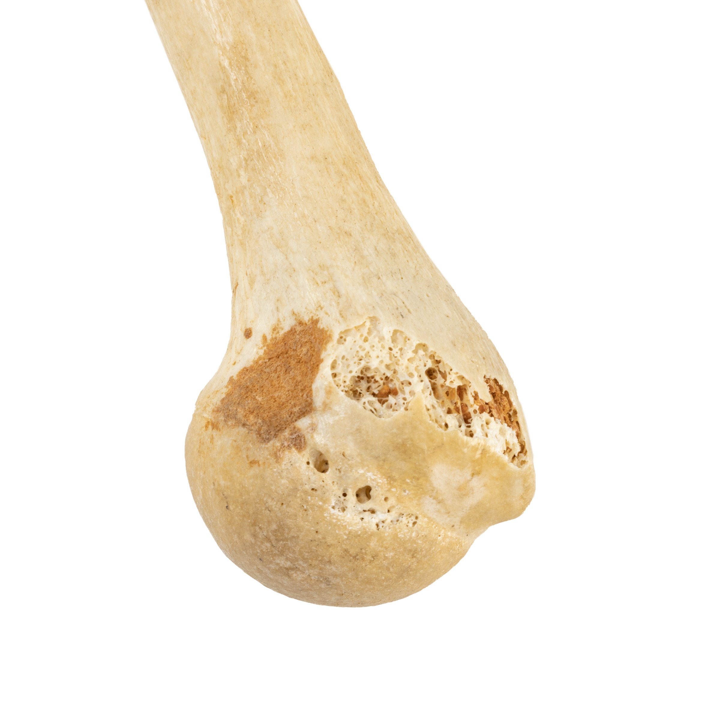Authentic Human Humerus, Radius & Ulna Bones - Medical Education, Anatomy Study & Science Classroom Specimen