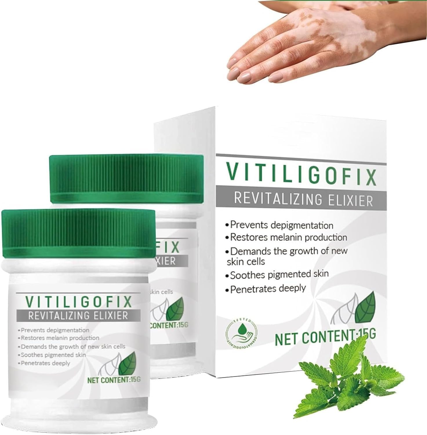 Vitiligo Treatment Cream - White Spot Remover & Skin Pigmentation Corrector | Soothing Moisturizer for Vitiligo Care | Reduces White Patches & Improves Skin Tone (2 Pack) - Ideal for Daily Skincare Routine & Spot Treatment