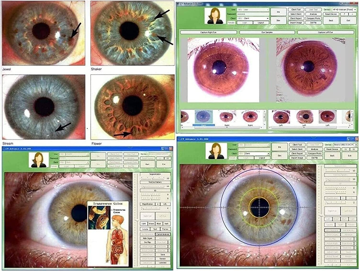 5.0MP USB Iridology Camera with Pro Iris Analysis Software - HD 30x Lens Iris Magnifier for Eye Health Diagnosis | Perfect for Naturopaths, Holistic Practitioners & Eye Care Professionals