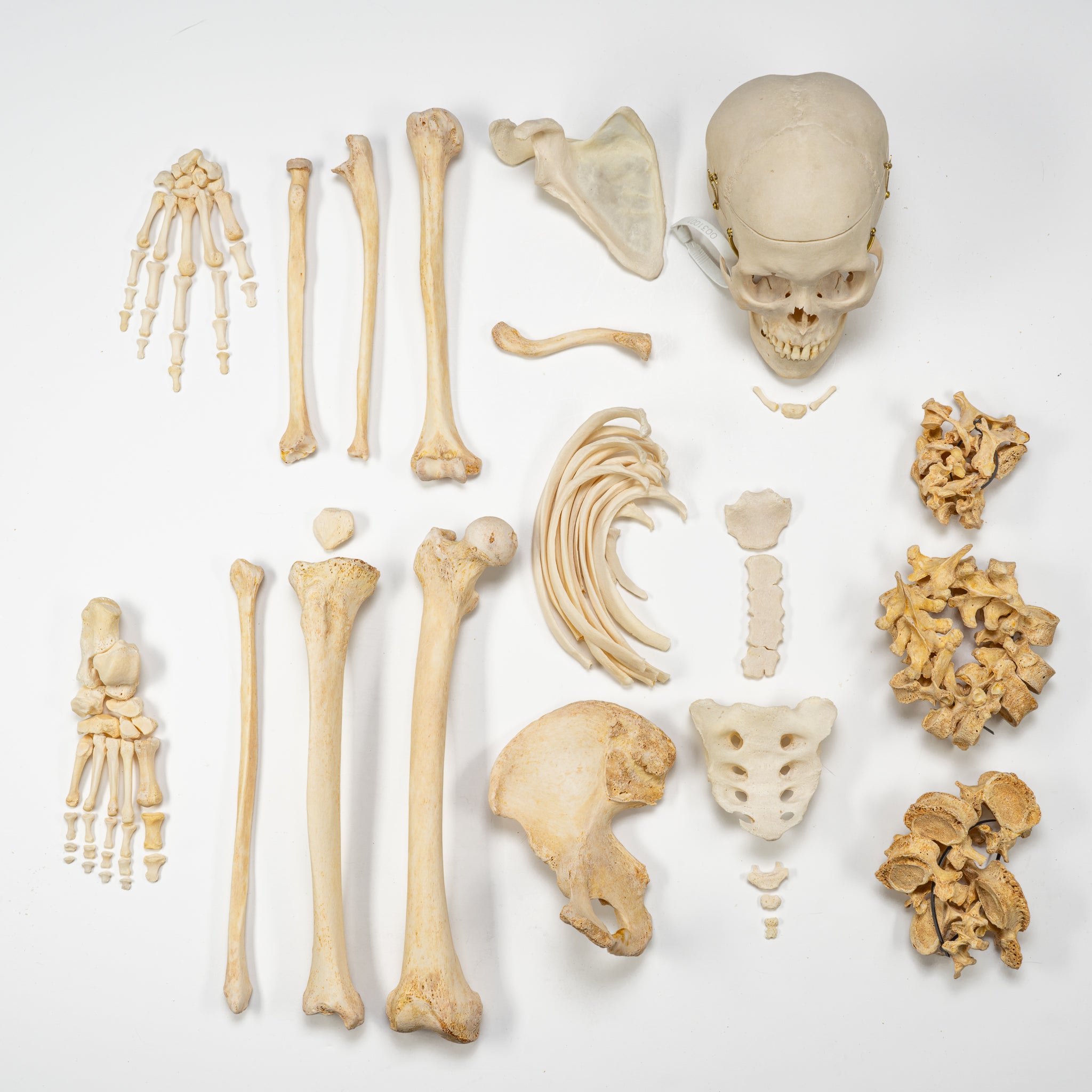 Real Human Half Skeleton Disarticulated - Anatomical Model for Medical Students, Science Classrooms & Halloween Decor