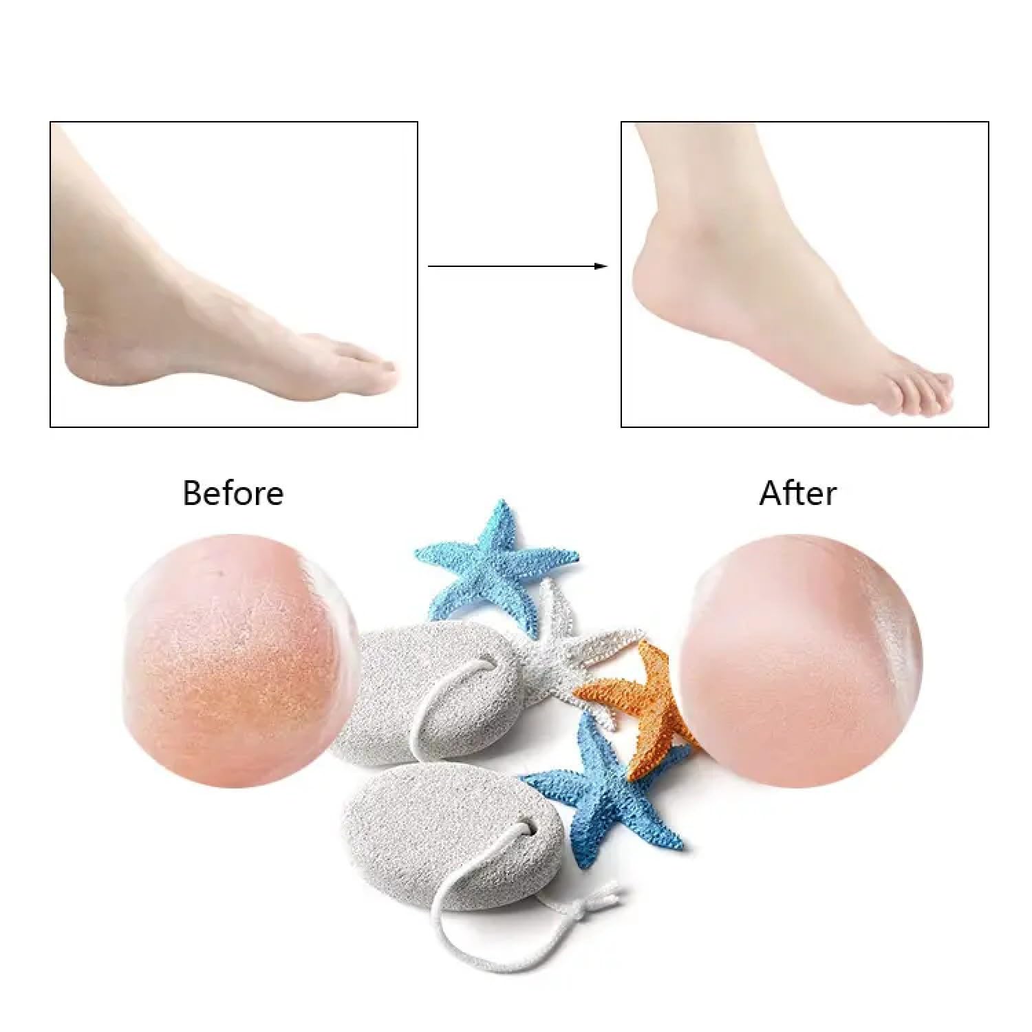 KRIVETY Natural Lava Pumice Stone for Feet - Callus Remover & Exfoliator for Hands, Heels & Elbows - Pedicure Tool for Dead Skin Removal - Foot Scrubber for Soft Smooth Skin (Pack of 1) - Perfect for At-Home Spa, Pedicure & Foot Care Routine