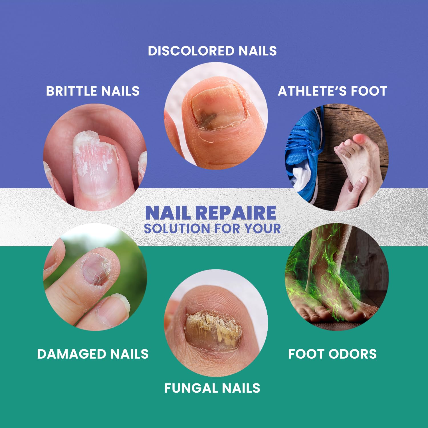 Extra Strength Toenail Repair Treatment for Thick, Broken, Discolored & Damaged Nails - 1oz Nail Renewal Solution - Perfect for Fungal Nail Care & Pedicure Prep at Home