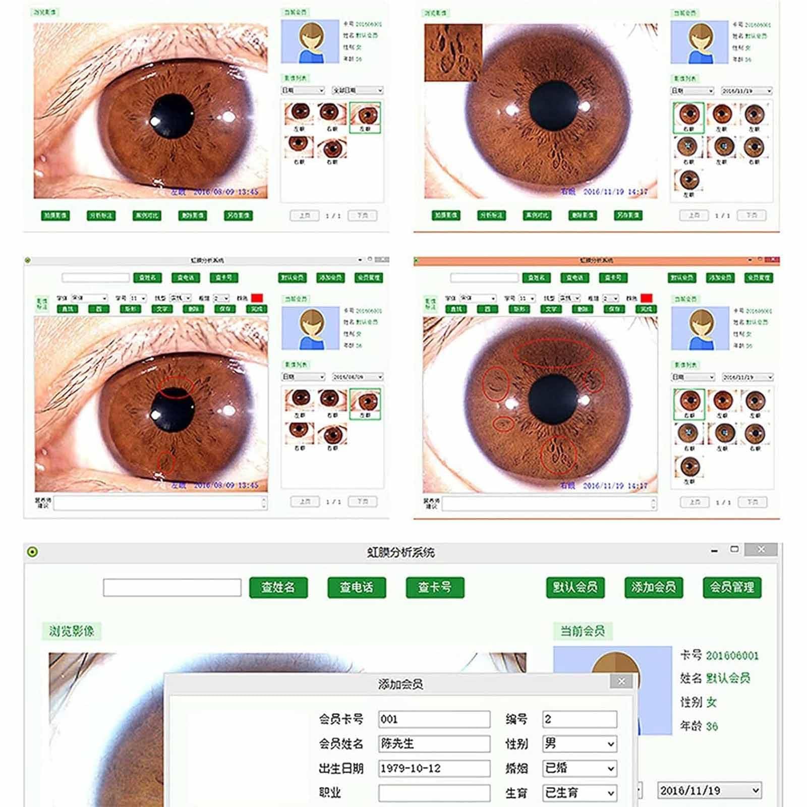 DaMga 30X Iris Analysis Camera with 5.0MP USB Detector - High Resolution 2560x1920 Iridology Camera with Left/Right Lamp & Analysis Software - Perfect for Eye Health Diagnosis, Alternative Medicine Practice, and Holistic Wellness Assessment