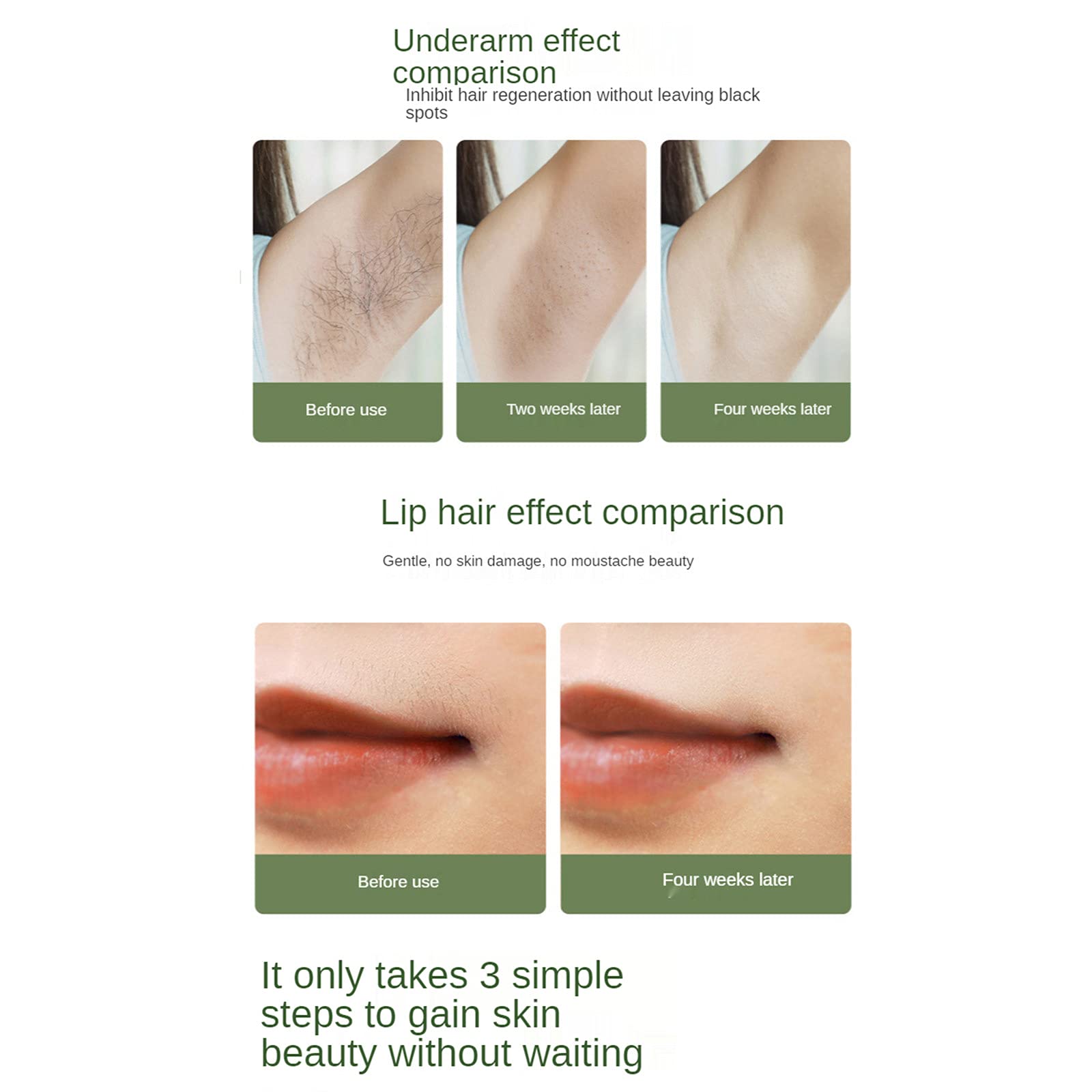 Professional IPL Hair Removal Device with Ice Cooling Technology - 999,999 Flashes Permanent Hair Removal System for Women & Men - Painless At-Home Hair Removal for Face, Body, Bikini Area - Perfect for Smooth Skin Before Beach Vacation or Special Occasions