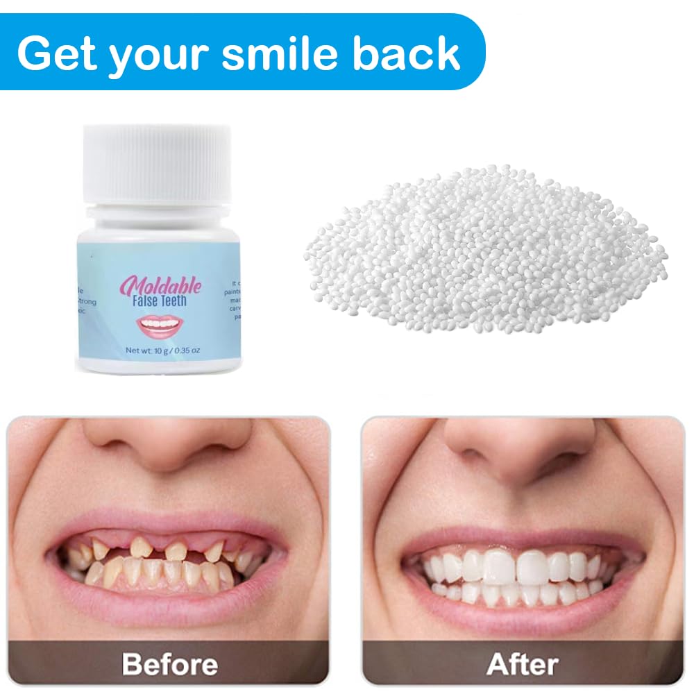 Temporary Teeth Repair Kit - Dental False Tooth Replacement for Emergency Fix & Teaching - Perfect for Travel, Home Use, and Dental Practice