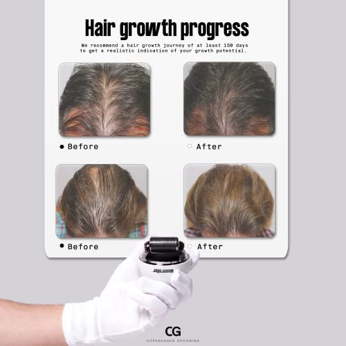 Copenhagen Grooming Men's Hair Growth Kit with Activator Serum & Moonroller Follicle Stimulator - Natural Hair Regrowth Treatment for Thinning Hair & Baldness - Gentle & Effective for Daily Use at Home or Travel (250 Day Supply)