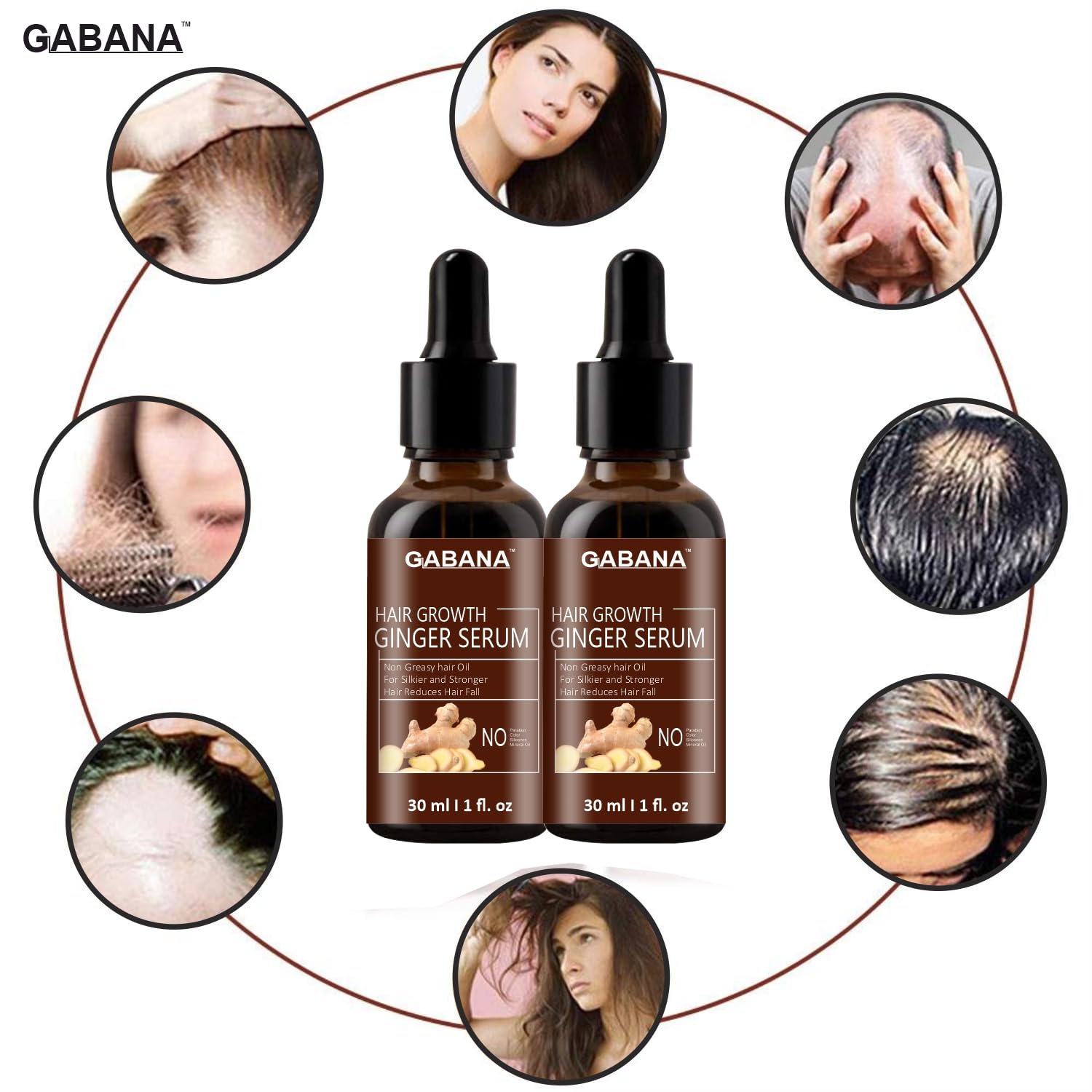 GABANA Hair Growth Ginger Serum for Men & Women - 3 Pack (30ml Each) | Natural Hair Loss Treatment for Strong, Silky & Frizzy Hair | Promotes Hair Regrowth & Thickness | Perfect for Daily Hair Care Routine & Scalp Massage