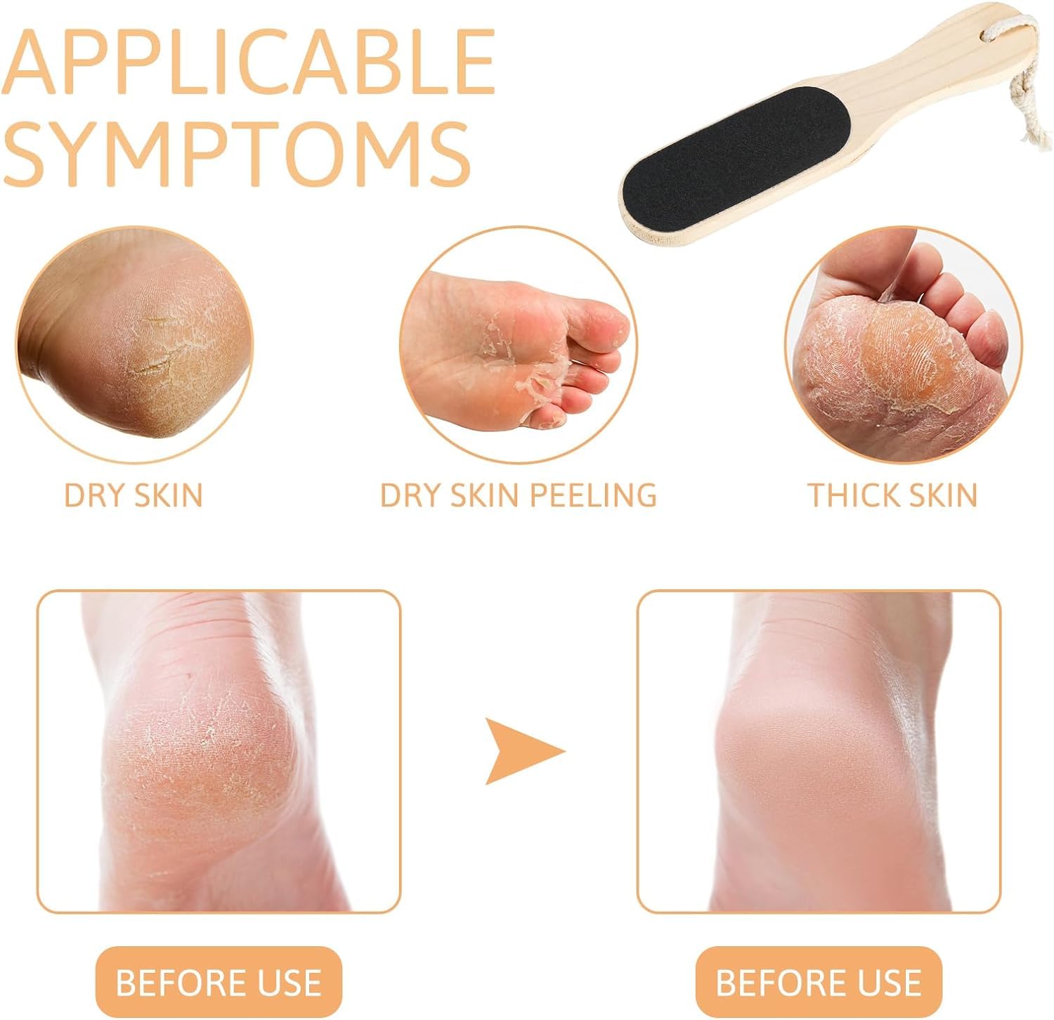 Premium Double-Sided Wooden Foot File & Callus Remover - Reusable Manual Pedicure Tool for Hard Skin & Dead Skin Removal | Includes 2 Bath Sponges | Perfect for At-Home Pedicures, Foot Care & Spa Treatments
