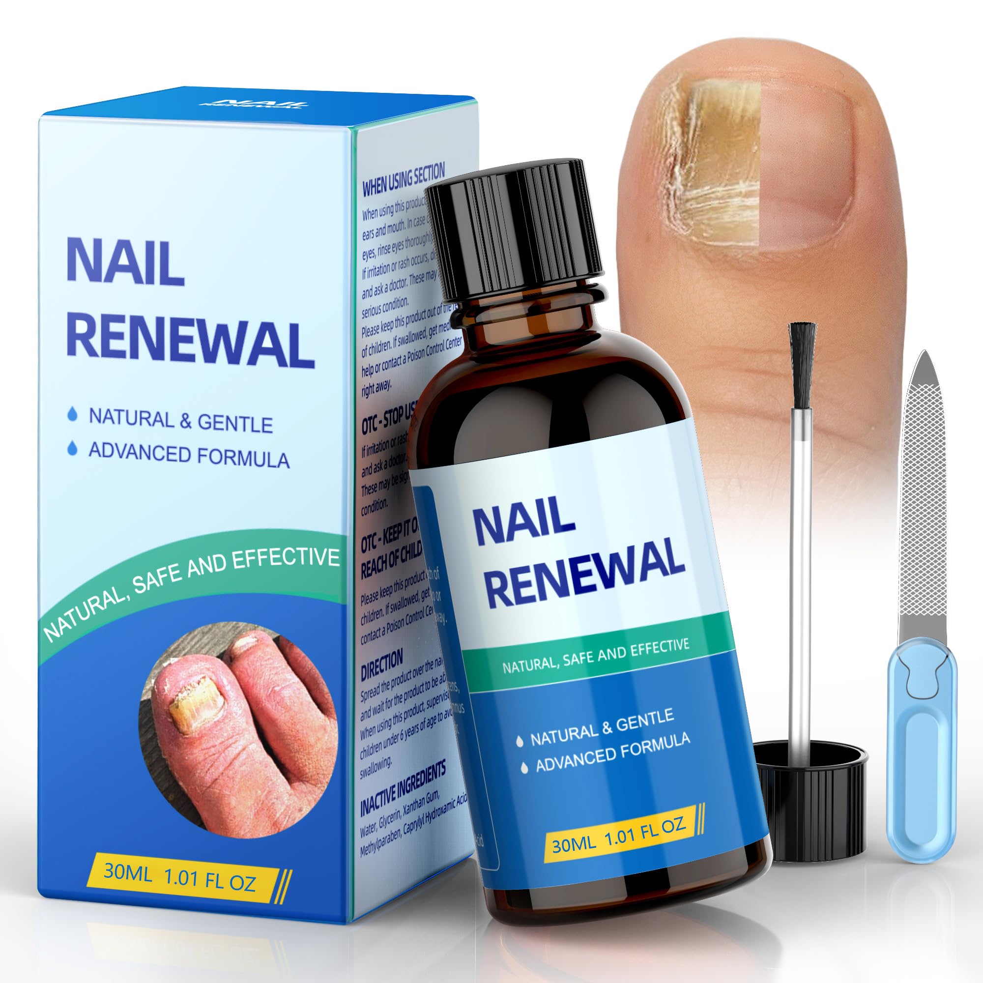 5X Extra Strength Toenail Fungus Treatment with Acetic Acid - Effective Nail Repair for Damaged, Discolored Toenails & Fingernails - Athlete's Foot Relief (1.01oz) - Perfect for Daily Use at Home, Gym, or Travel