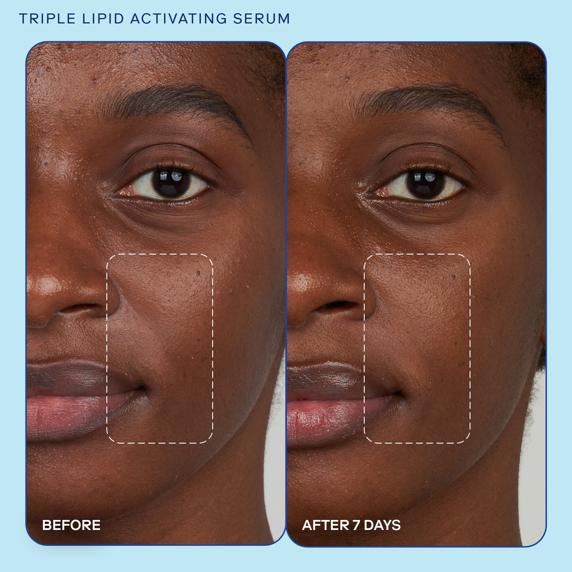 Barrier+ Triple Lipid Activating Serum for Face - Anti-Aging Moisturizing Treatment with Ceramides | Day & Night Hydration for Dry, Sensitive Skin