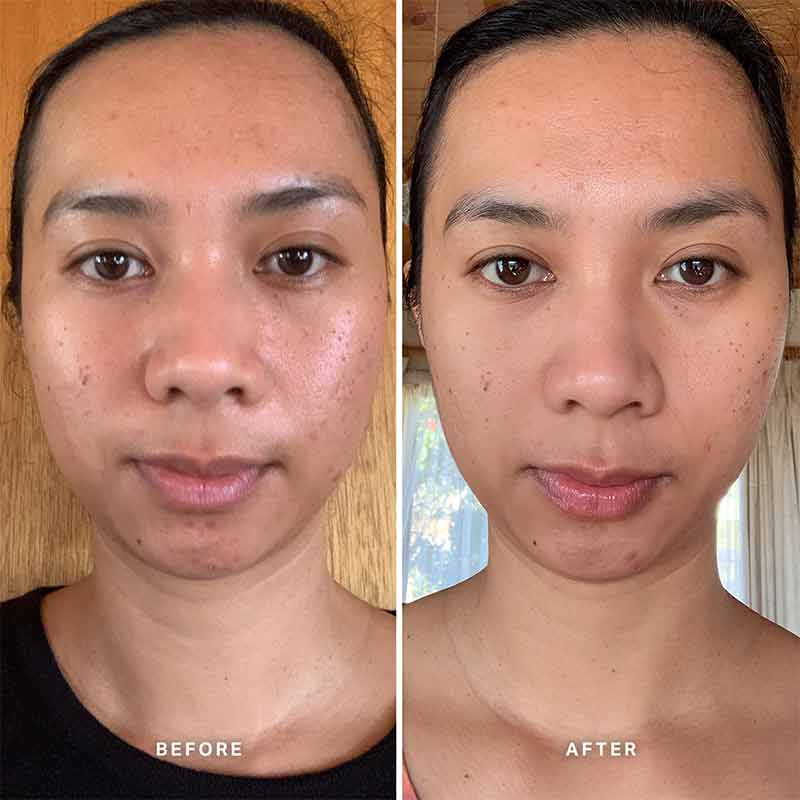 Alpha H Vitamin C Serum with 10% Ethyl Ascorbic Acid - Brightening & Anti-Aging Face Serum for Dark Spots & Wrinkles - Perfect for Daily Skincare Routine & Nighttime Use