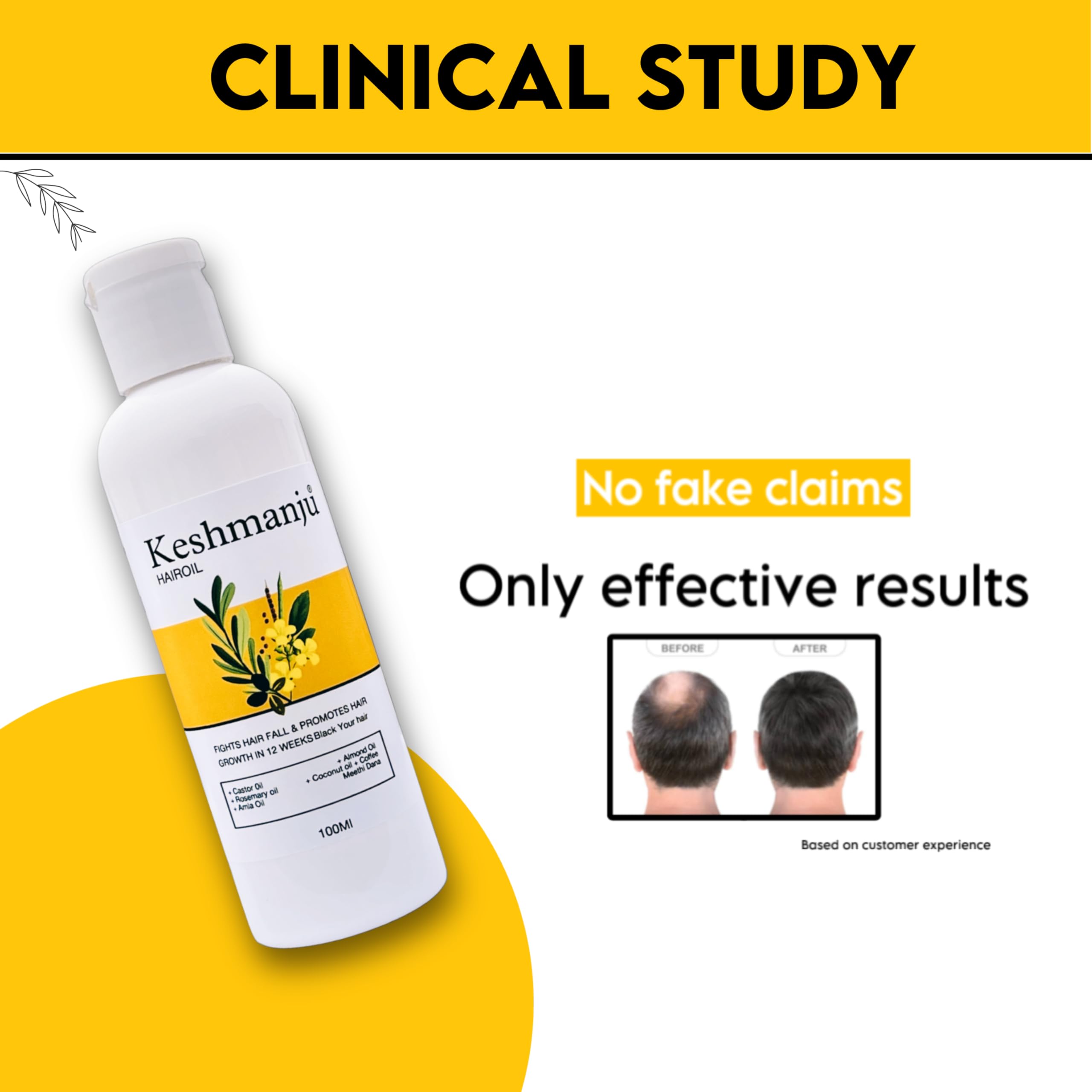 Keshmanju Hair Oil for Hair Growth - Reduces Hair Fall & Prevents Grey Hair - Natural Treatment for Stronger, Healthier Hair - Perfect for Daily Use & Scalp Care