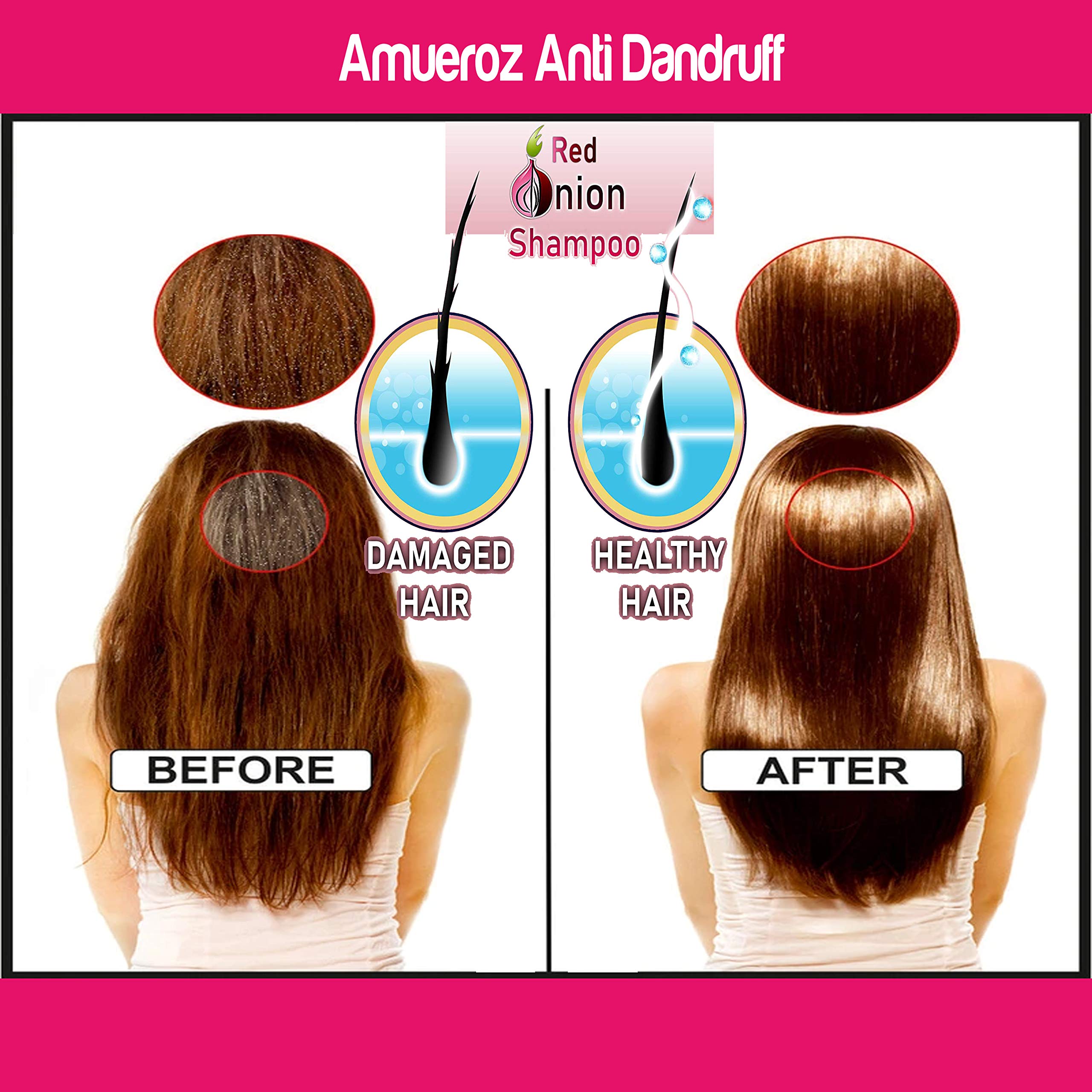 Amueroz Onion Shampoo for Hair Growth & Black Seed Hair Oil Set - 200ml Shampoo + 60ml Oil with Red Onion Extract | Natural Hair Care for Thinning Hair, Hair Loss Treatment & Scalp Health | Daily Use for Men & Women