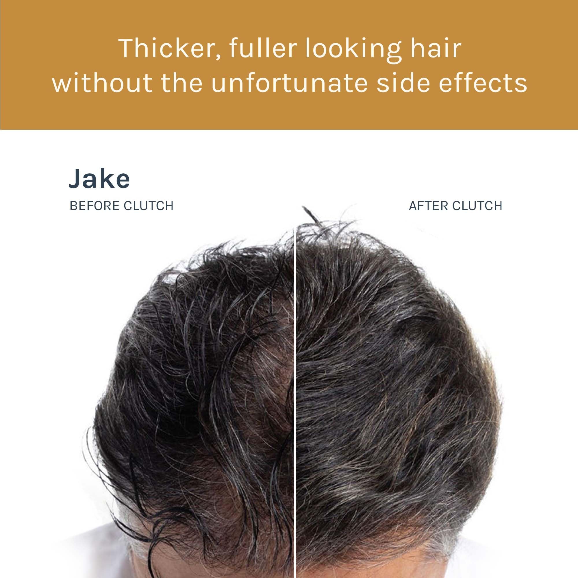 Advanced Hair Density Serum for Thicker & Fuller Hair - Safe & Effective Hair Loss Treatment (1 fl oz) - Perfect for Daily Use & Styling