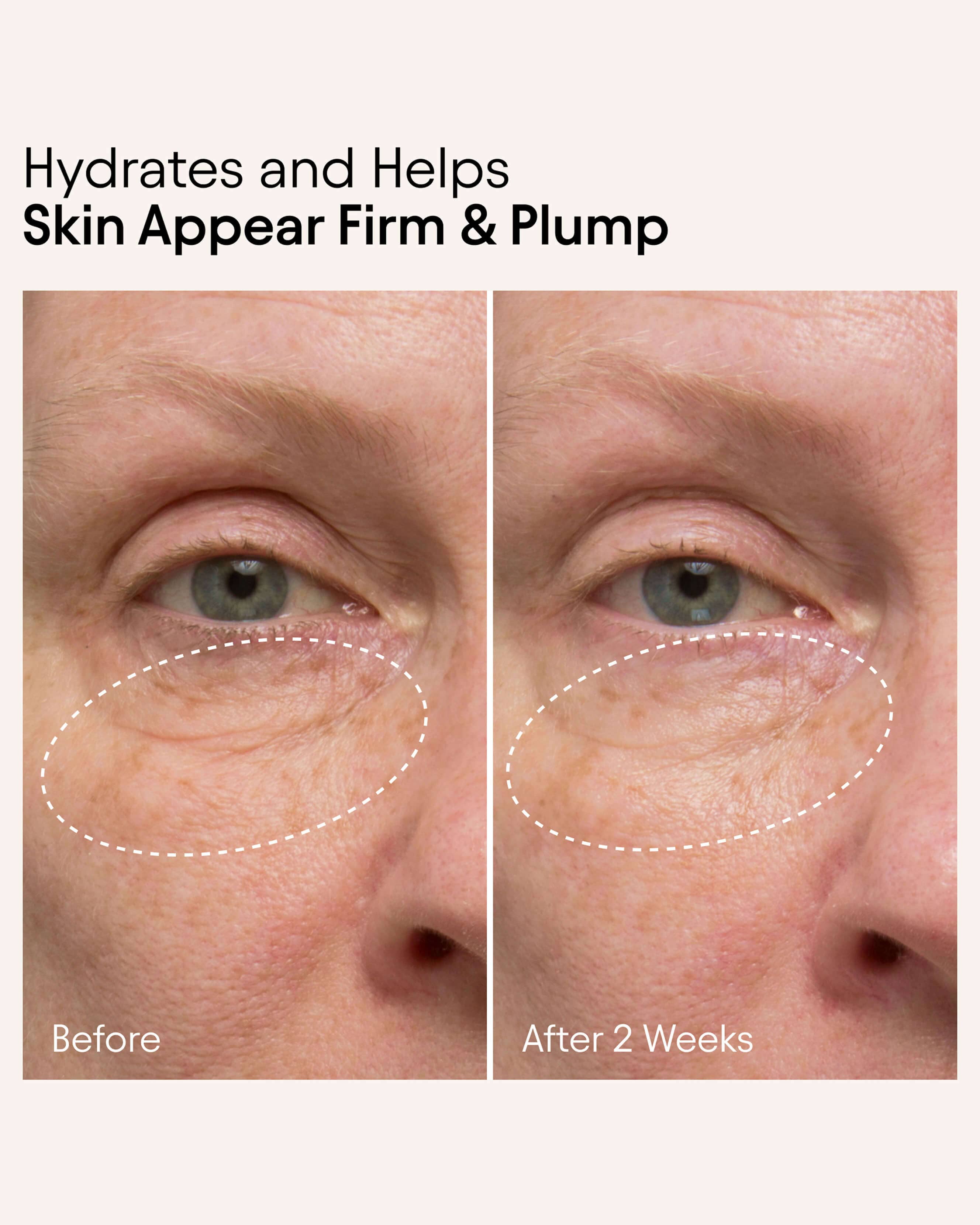 Niacinamide & Nettle Hydrating Firming Serum for Face - Anti-Aging & Moisturizing Skincare for Day & Night Use