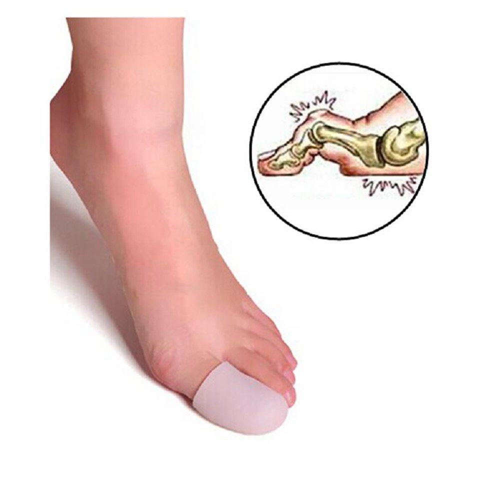 5 Pairs Breathable Silicone Gel Toe Caps for Ingrown Toenails - Big Toe Protector Pads & Sleeves for Pain Relief & Comfort (Ideal for Running, Hiking & Daily Wear)