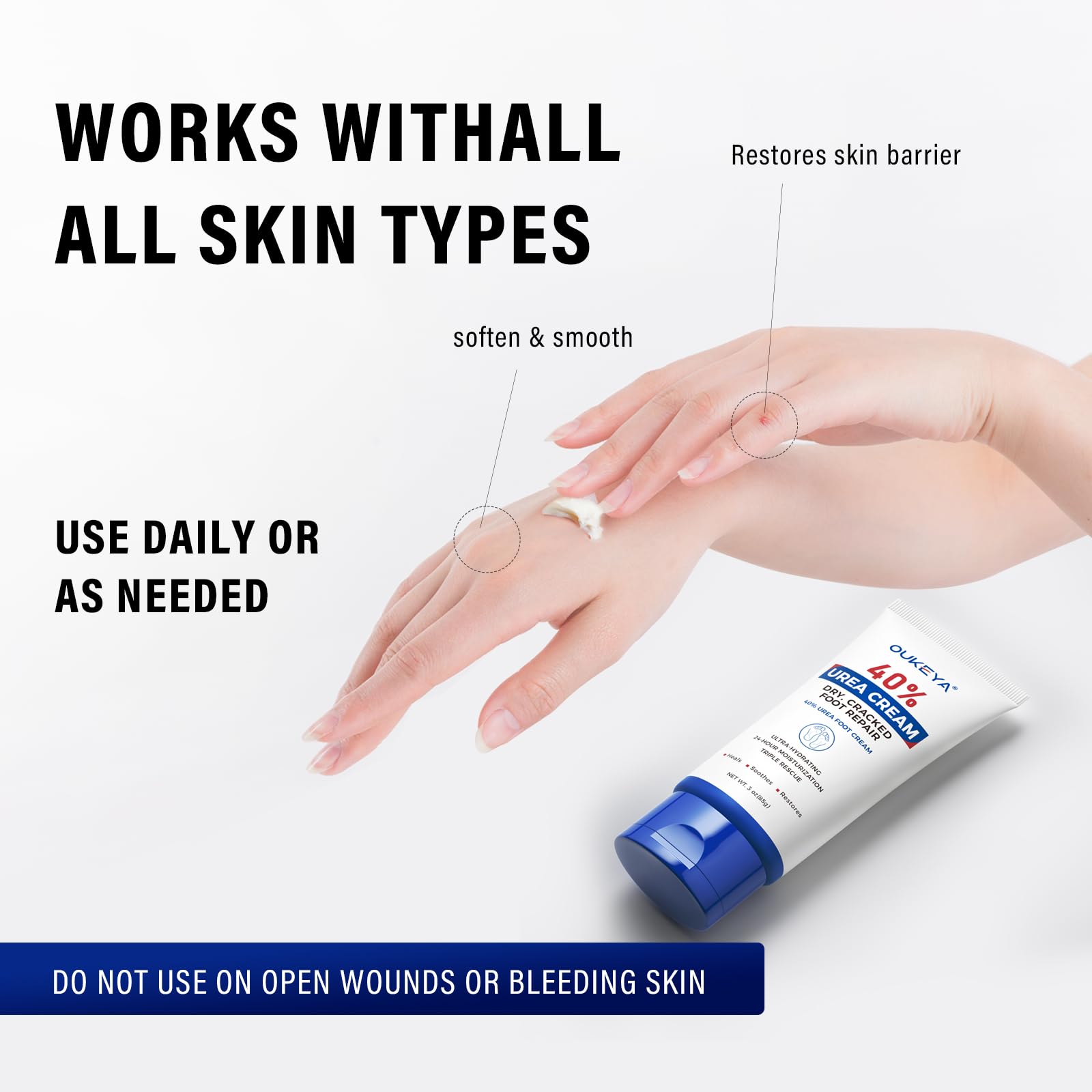 40% Urea Cream for Dry Cracked Hands & Feet - Maximum Strength Moisturizing Lotion (3 Oz Tube) - Ideal for Cracked Heels, Rough Skin & Severe Dryness Relief