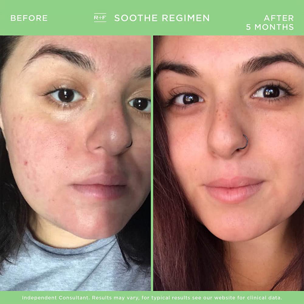 Rodan and Fields Soothe Regimen - Sensitive Skin Care Set for Irritation & Facial Redness Relief | Gentle Daily Skincare Routine for Dry, Reactive Skin | Perfect for Eczema & Rosacea Prone Skin