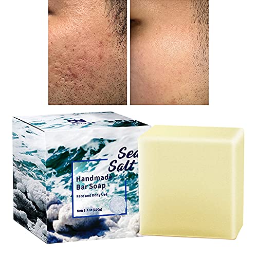 ONIYEA Natural Goat's Milk & Sea Salt Handmade Soap Bar 3.5oz - Exfoliating Acne Treatment for Face & Body - Deep Cleansing for All Skin Types - Perfect Skincare Gift for Women & Men (Birthday/Mother's Day/Valentine's) - Ideal for Sensitive Skin & Problem Skin Care Routine