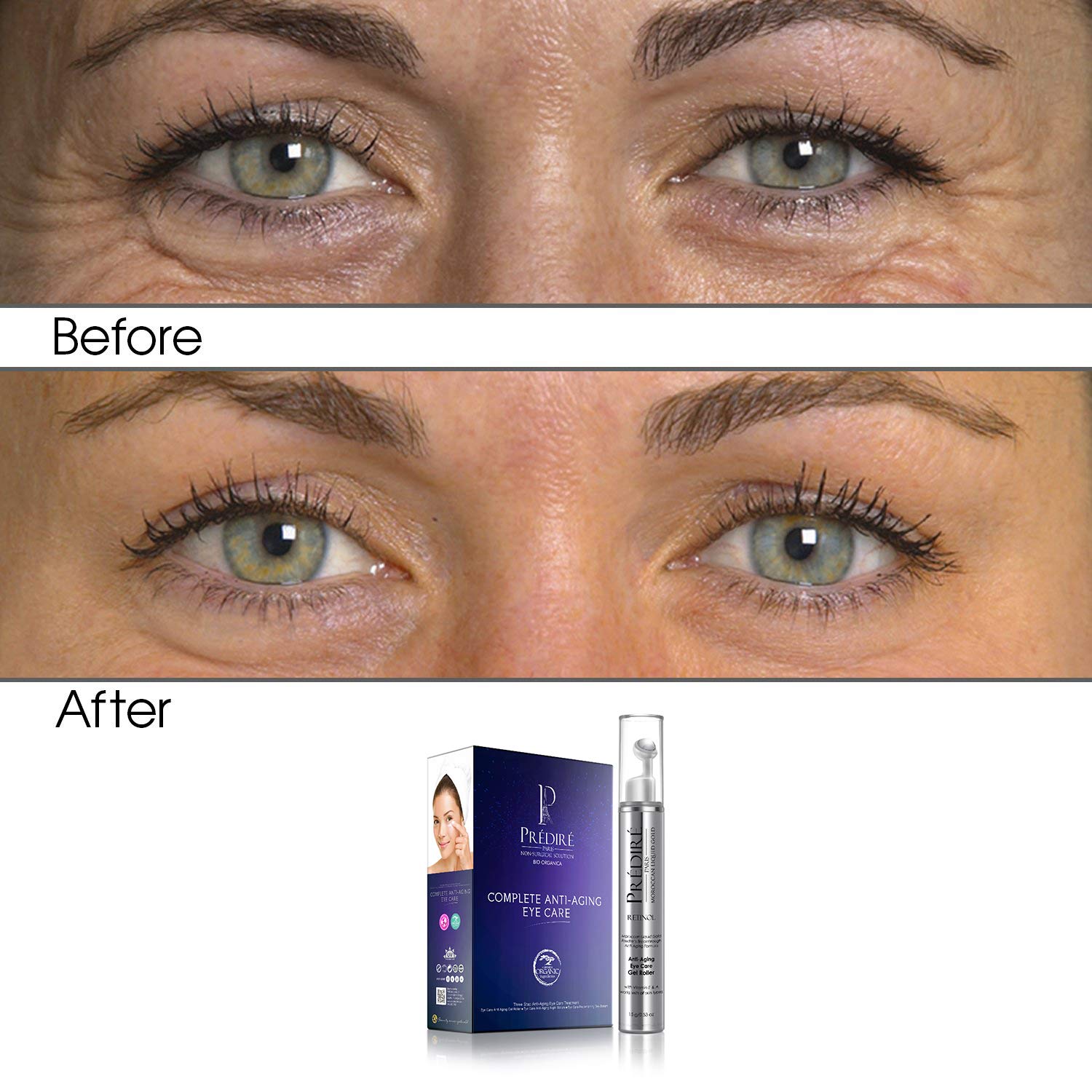 Travel Size Intensive Rapid Renewal Eye Care Anti-Aging Gel Roller - Reduces Puffiness & Dark Circles - Perfect for Overnight Recovery & Morning Refreshment