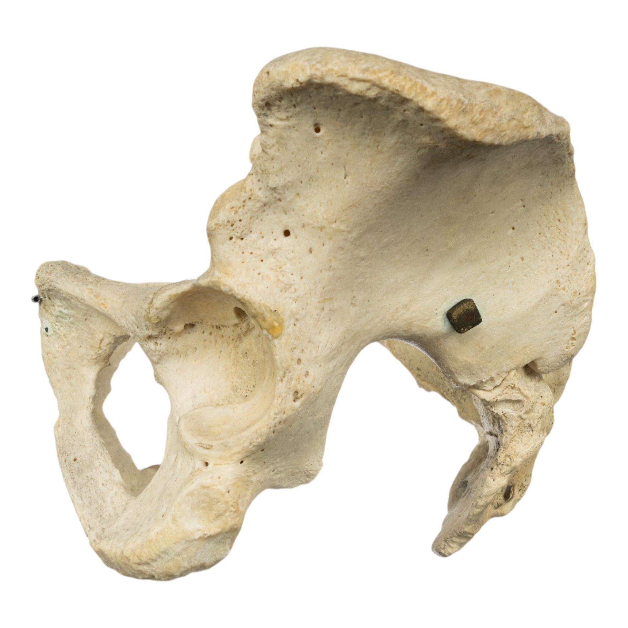 Real Human Pelvis and Sacrum Articulated - Anatomical Model for Medical Education, Study, and Display