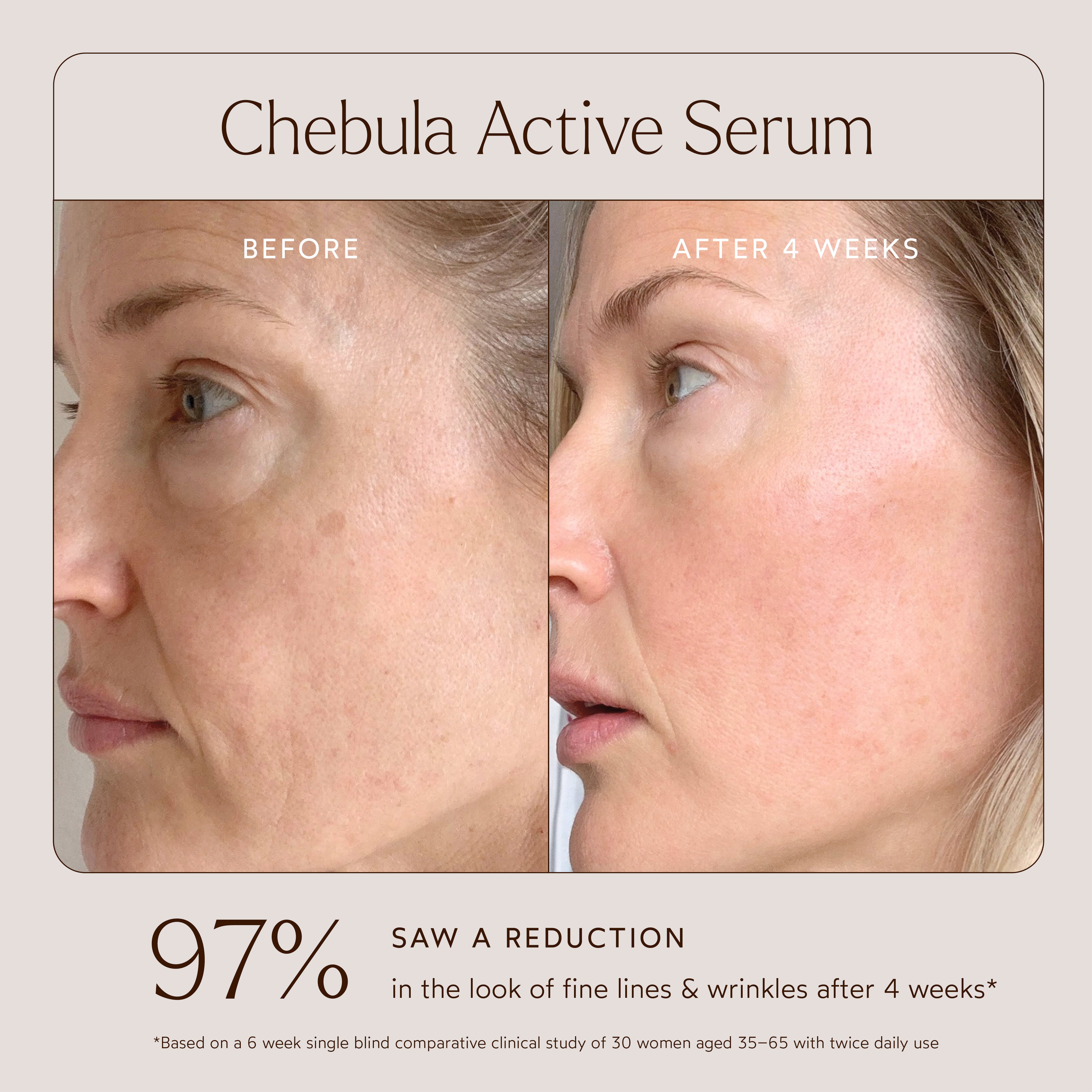 Chebula Active Anti-Aging Serum for Face - Organic Wrinkle Treatment & Skin Tightening Cream - Best for Night Routine, Dry Skin Care & Mature Skin Rejuvenation