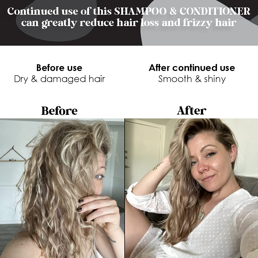 Biotin Shampoo and Conditioner Set for Hair Growth - Vitamin E, A, C & B Enriched Formula to Strengthen & Thicken Hair - Sulfate Free & Paraben Free (8.5oz) - Perfect for Thinning Hair, Damaged Hair & Daily Hair Care Routine