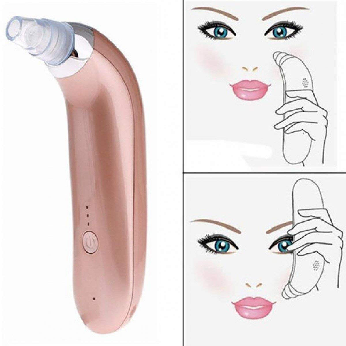 Nirva Electric Blackhead Remover - Pore Cleaner for Face Care