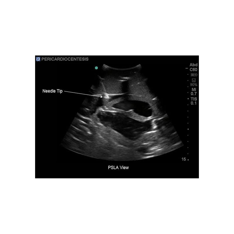 FAST Exam Ultrasound Training Model - Transthoracic & Transesophageal Echo Simulator for Cardiac Sonography Practice (Ideal for Medical Students, Ultrasound Tech Training & Clinical Skills Development)