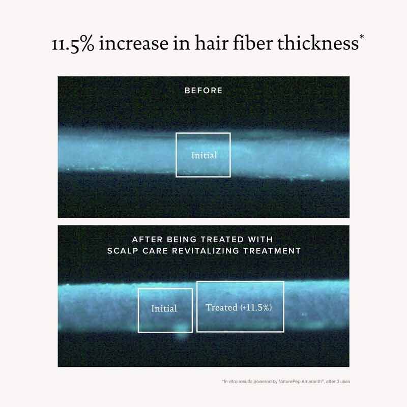 Living Proof Scalp Care Revitalizing Treatment for Dry Itchy Scalp - Sulfate Free Hair Growth Serum with Biotin & Caffeine - Perfect for Thinning Hair & Scalp Health - Use for Daily Scalp Massage & Hair Regrowth