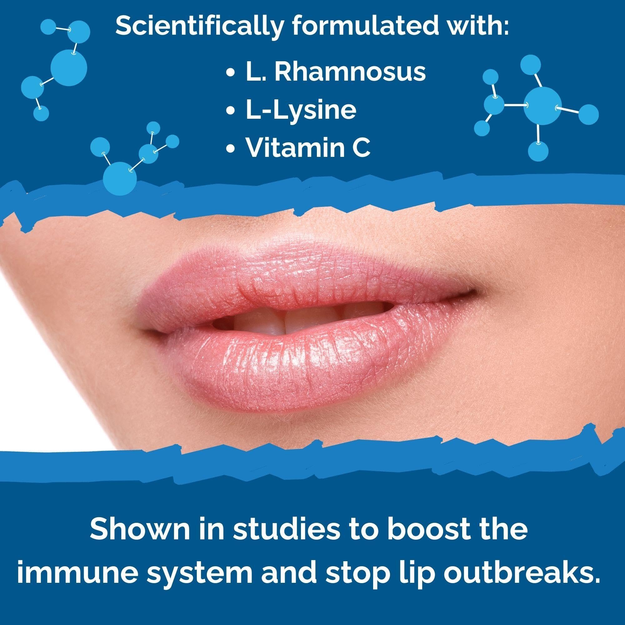 Best Cold Sore Treatment for Lips - Lysine Cream with Acidophilus Probiotic, Lactobacillus Rhamnosus & Vitamin C - Fast Healing Lip Balm for Skin Health & Immune Support - Perfect for Daily Use, Travel & Cold Weather Protection