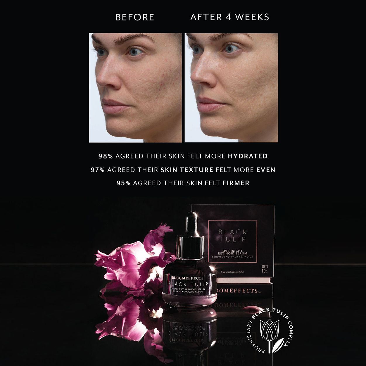 Black Tulip Overnight Retinoid Serum for Face - Anti-Aging Night Treatment with Retinol - Reduce Wrinkles & Fine Lines - Perfect for Dry & Sensitive Skin - Use Before Bed for Glowing Morning Skin
