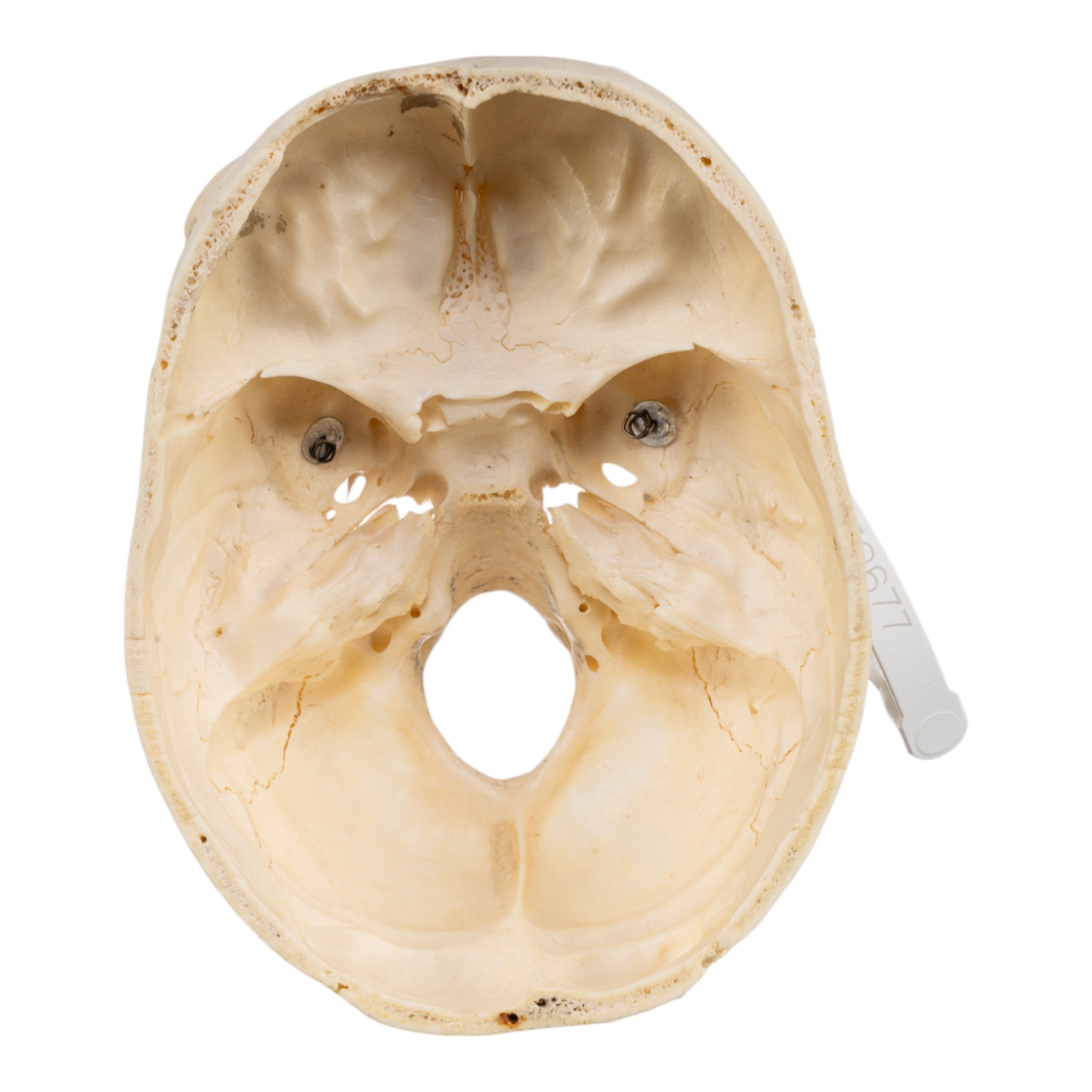 Authentic Real Human Skull - Partial Bone Specimen for Medical Study, Anatomy Education & Gothic Decor - Perfect for Halloween, Haunted Houses & Scientific Research