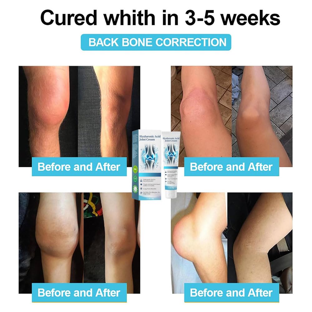 Arthroheal Hyaluronic Acid Joint Repair Cream - Relief for Arthritis, Joint & Bone Pain in Hands, Feet & Knees - Moisturizing & Soothing Formula for Active Lifestyles & Daily Comfort (1 Pack)