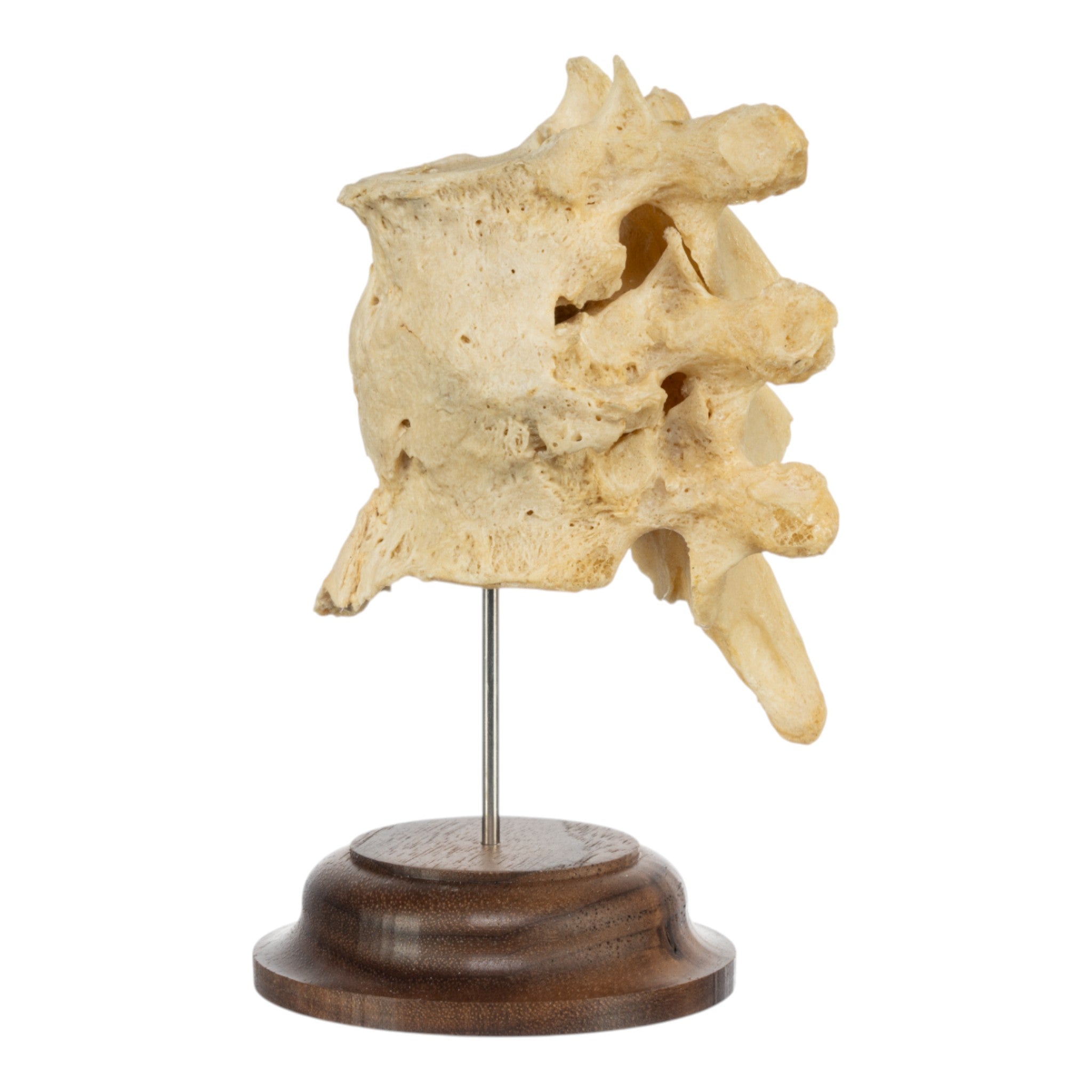 Authentic Human Fused Vertebrae Specimen - Medical Educational Display for Anatomy Study, Classroom Teaching & Doctor's Office Decoration