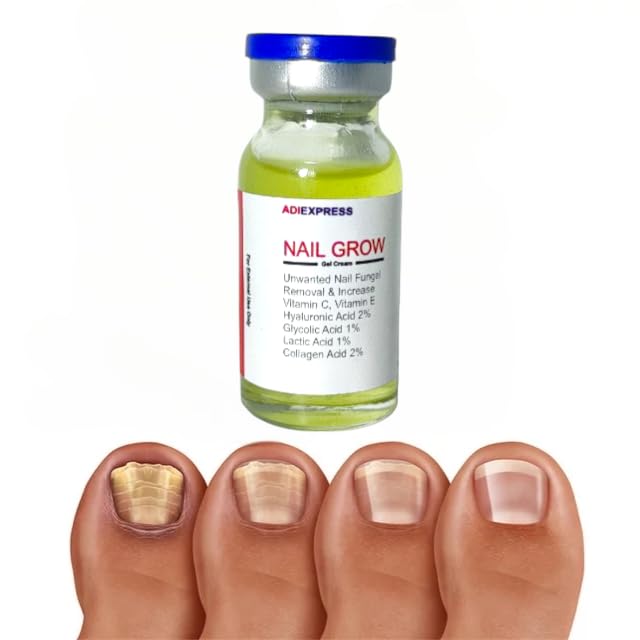 Nail Strengthening Gel Oil - Nourishing & Brightening Treatment for Strong, Smooth, Healthy Nails | Promotes Healthy Nail Growth | Ideal for Nail Fungus Prevention & At-Home Manicures