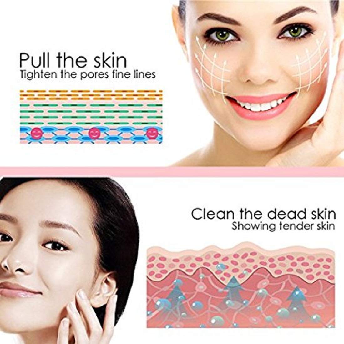 Exesoon Electric Facial Pore Cleanser & Blackhead Remover - Professional Vacuum Suction Skincare Device for Women | Microdermabrasion Machine for Acne, Pimples & Smooth Skin | Perfect for Daily Beauty Routine & Spa Treatments
