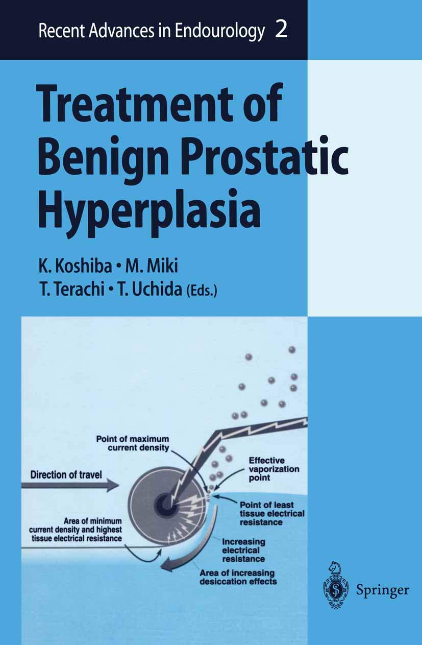 Benign Prostatic Hyperplasia Treatment Guide - Latest Endourology Advances & BPH Relief Solutions | For Men's Prostate Health & Urinary Comfort