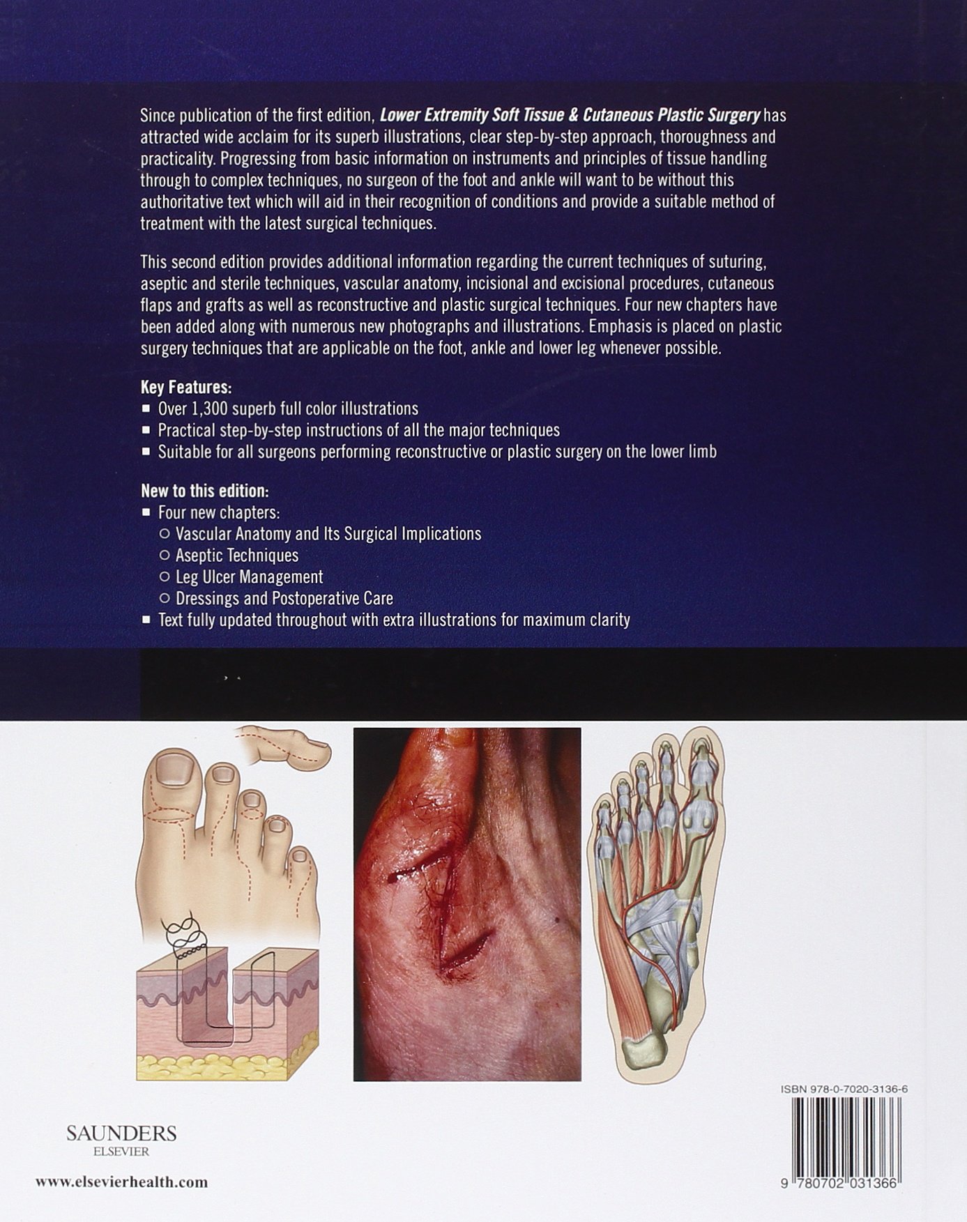 Lower Extremity Soft Tissue & Cutaneous Plastic Surgery - Advanced Wound Care & Skin Reconstruction Solutions for Foot & Leg Injuries | Ideal for Post-Trauma Recovery, Diabetic Ulcers & Cosmetic Procedures