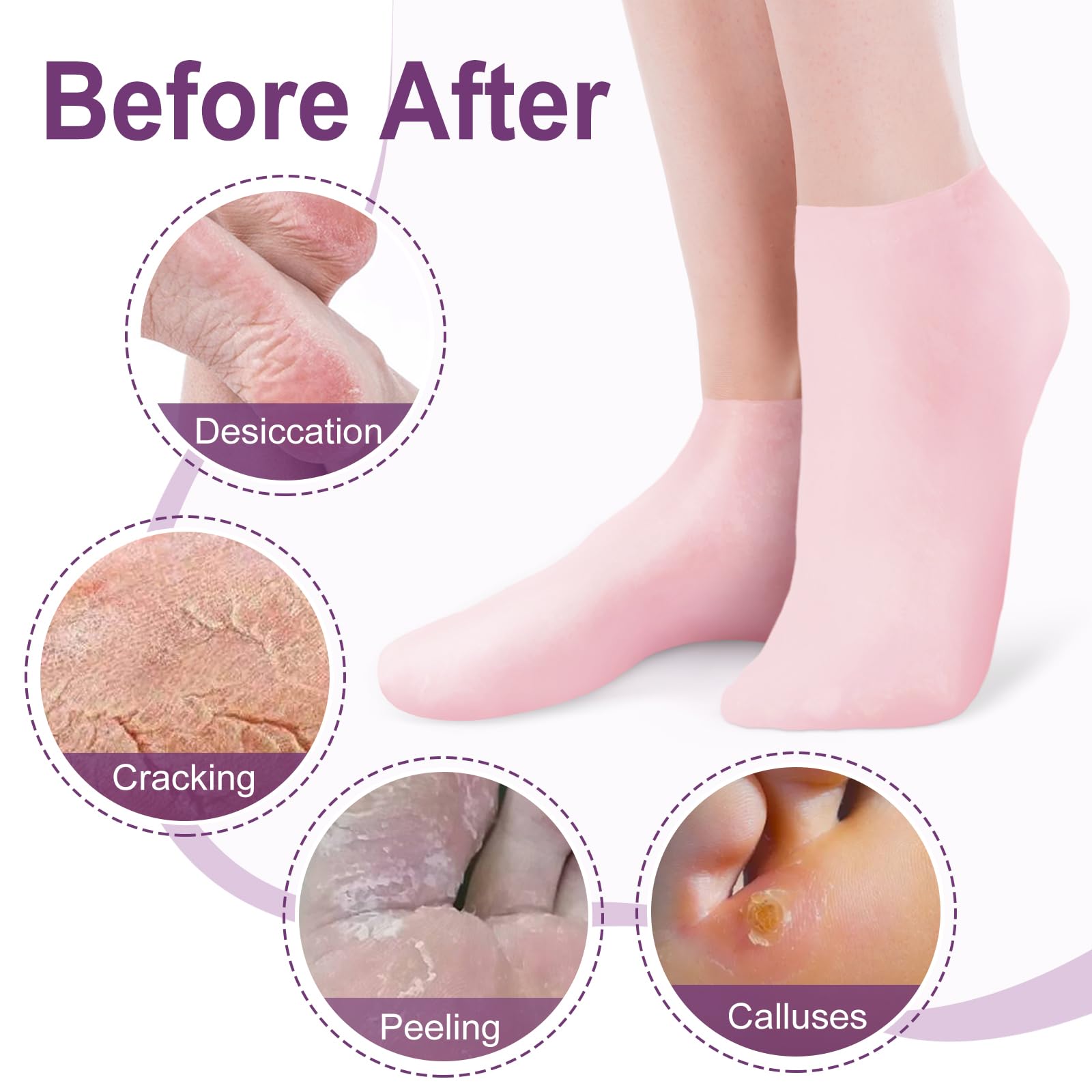 NOVAYARDTM Silicone Moisturizing Socks for Dry Cracked Feet - Anti-Slip Gel Foot Care Socks (3 Pairs: Pink, Nude & White, XL) - Perfect for Overnight Foot Treatment, Pedicure & Cracked Heel Recovery