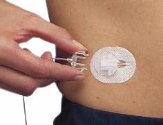 Premium Clear Infusion Set for IV Therapy - Medical Grade Disposable Needle Set for Home Healthcare, Hospitals & Clinics - Ideal for Hydration, Medication & Nutrient Delivery